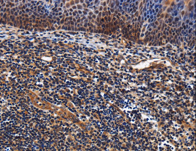LRRC57 Antibody - Immunohistochemistry of paraffin-embedded Human tonsil using LRRC57 Polyclonal Antibody at dilution of 1:40.