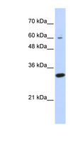 LRRC57 Antibody - LRRC57 antibody Western blot of Transfected 293T cell lysate. This image was taken for the unconjugated form of this product. Other forms have not been tested.