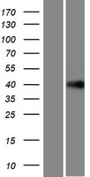 LRRC58 Protein - Western validation with an anti-DDK antibody * L: Control HEK293 lysate R: Over-expression lysate