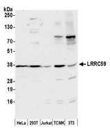 LRRC59 Antibody - Detection of human and mouse LRRC59 by western blot. Samples: Whole cell lysate (50 µg) from HeLa, HEK293T, Jurkat, mouse TCMK-1, and mouse NIH 3T3 cells prepared using NETN lysis buffer. Antibody: Affinity purified rabbit anti-LRRC59 antibody used for WB at 0.1 µg/ml. Detection: Chemiluminescence with an exposure time of 30 seconds.