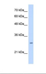 LRRC59 Antibody - HepG2 cell lysate. Antibody concentration: 0.25 ug/ml. Gel concentration: 12%.  This image was taken for the unconjugated form of this product. Other forms have not been tested.