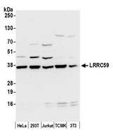 LRRC59 Antibody - Detection of human and mouse LRRC59 by western blot. Samples: Whole cell lysate (50 µg) from HeLa, HEK293T, Jurkat, mouse TCMK-1, and mouse NIH 3T3 cells prepared using NETN lysis buffer. Antibody: Affinity purified rabbit anti-LRRC59 antibody used for WB at 0.1 µg/ml. Detection: Chemiluminescence with an exposure time of 10 seconds.