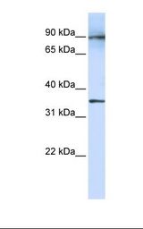 LRRC59 Antibody - Fetal lung lysate. Antibody concentration: 1.0 ug/ml. Gel concentration: 12%.  This image was taken for the unconjugated form of this product. Other forms have not been tested.