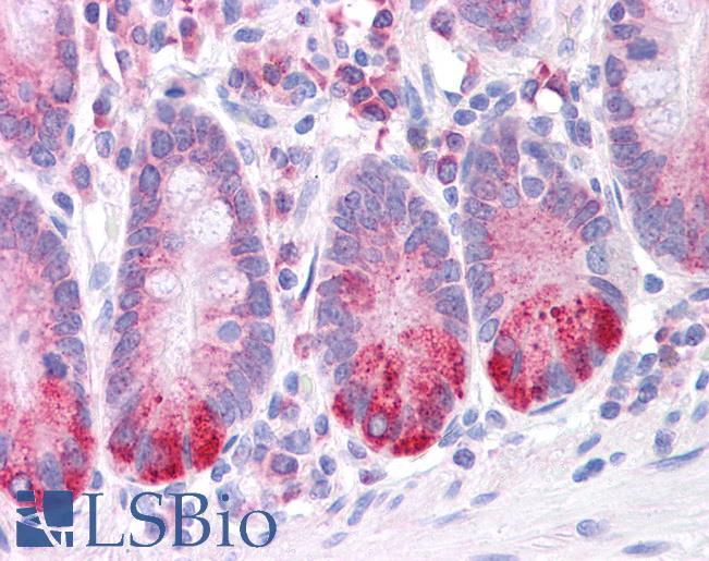 LRRC59 Antibody - Anti-LRRC59 antibody IHC of human small intestine. Immunohistochemistry of formalin-fixed, paraffin-embedded tissue after heat-induced antigen retrieval. Antibody concentration 5 ug/ml.  This image was taken for the unconjugated form of this product. Other forms have not been tested.