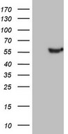 LRRC6 Antibody - HEK293T cells were transfected with the pCMV6-ENTRY control. (Left lane) or pCMV6-ENTRY LRRC6. (Right lane) cDNA for 48 hrs and lysed. Equivalent amounts of cell lysates. (5 ug per lane) were separated by SDS-PAGE and immunoblotted with anti-LRRC6.