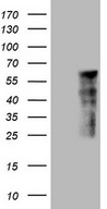 LRRC6 Antibody - HEK293T cells were transfected with the pCMV6-ENTRY control. (Left lane) or pCMV6-ENTRY LRRC6. (Right lane) cDNA for 48 hrs and lysed. Equivalent amounts of cell lysates. (5 ug per lane) were separated by SDS-PAGE and immunoblotted with anti-LRRC6.