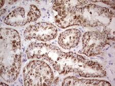 LRRC6 Antibody - Immunohistochemical staining of paraffin-embedded Human Kidney tissue within the normal limits using anti-LRRC6 mouse monoclonal antibody.  Dilution: 1:150