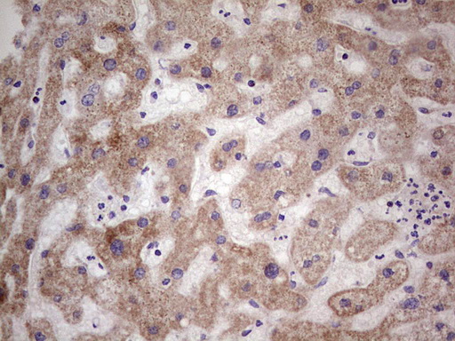 LRRC6 Antibody - Immunohistochemical staining of paraffin-embedded Human liver tissue within the normal limits using anti-LRRC6 mouse monoclonal antibody.  Dilution: 1:150