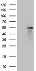 LRRC6 Antibody - HEK293T cells were transfected with the pCMV6-ENTRY control. (Left lane) or pCMV6-ENTRY LRRC6. (Right lane) cDNA for 48 hrs and lysed. Equivalent amounts of cell lysates. (5 ug per lane) were separated by SDS-PAGE and immunoblotted with anti-LRRC6.