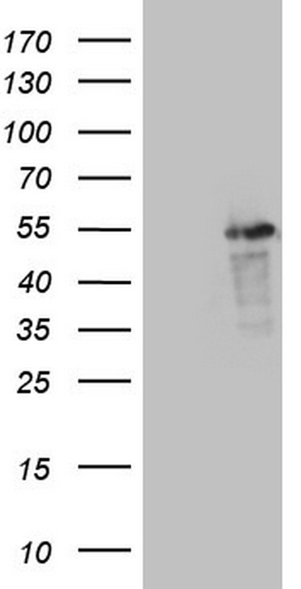 LRRC6 Antibody - HEK293T cells were transfected with the pCMV6-ENTRY control (Left lane) or pCMV6-ENTRY LRRC6 (Right lane) cDNA for 48 hrs and lysed. Equivalent amounts of cell lysates (5 ug per lane) were separated by SDS-PAGE and immunoblotted with anti-LRRC6.