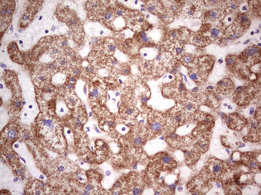 LRRC6 Antibody - Immunohistochemical staining of paraffin-embedded Human liver tissue within the normal limits using anti-LRRC6 mouse monoclonal antibody.  Dilution: 1:150