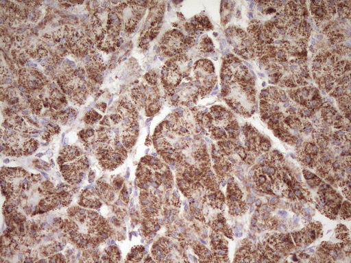 LRRC6 Antibody - Immunohistochemical staining of paraffin-embedded Human pancreas tissue within the normal limits using anti-LRRC6 mouse monoclonal antibody. (Heat-induced epitope retrieval by 1 mM EDTA in 10mM Tris, pH8.5, 120C for 3min,