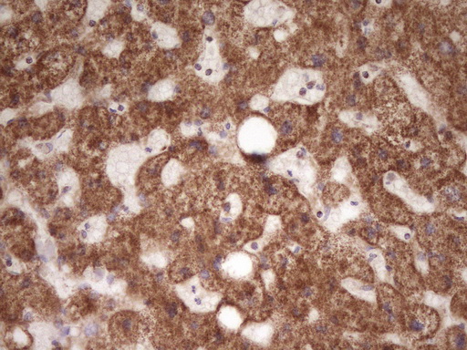 LRRC6 Antibody - Immunohistochemical staining of paraffin-embedded Human liver tissue within the normal limits using anti-LRRC6 mouse monoclonal antibody. (Heat-induced epitope retrieval by 1 mM EDTA in 10mM Tris, pH8.5, 120C for 3min,