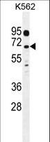 LRRC63 Antibody - LRRC63 Antibody western blot of K562 cell line lysates (35 ug/lane). The LRRC63 antibody detected the LRRC63 protein (arrow).