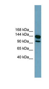 LRRC66 Antibody - LRRC66 antibody Western blot of ACHN lysate. This image was taken for the unconjugated form of this product. Other forms have not been tested.