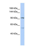 LRRC66 Antibody - LRRC66 antibody Western blot of Jurkat lysate. This image was taken for the unconjugated form of this product. Other forms have not been tested.