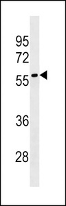 LRRC69 Antibody - LRRC69 Antibody western blot of HepG2 cell line lysates (35 ug/lane). The LRRC69 antibody detected the LRRC69 protein (arrow).
