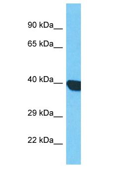 LRRC69 Antibody - LRRC69 antibody Western Blot of HepG2. Antibody dilution: 1 ug/ml.  This image was taken for the unconjugated form of this product. Other forms have not been tested.