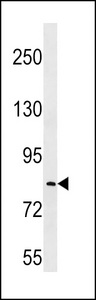 LRRC70 Antibody - LRRC70 Antibody western blot of MDA-MB231 cell line lysates (35 ug/lane). The LRRC70 antibody detected the LRRC70 protein (arrow).