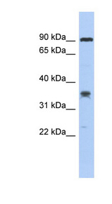 LRRC73 / C6orf154 Antibody - C6orf154 antibody Western blot of COLO205 cell lysate. This image was taken for the unconjugated form of this product. Other forms have not been tested.