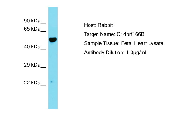 LRRC74A Antibody -  This image was taken for the unconjugated form of this product. Other forms have not been tested.