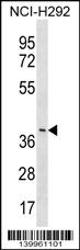 LRRC74B Antibody - YV012 Antibody (C-term) western blot analysis in NCI-H292 cell line lysates (35ug/lane).This demonstrates the YV012 antibody detected the YV012 protein (arrow).