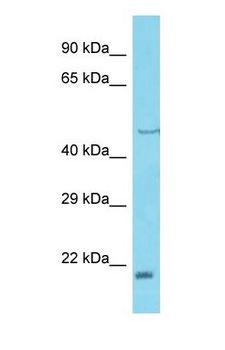 LRRC75A / C17orf76 Antibody - Western blot of FAM211A Antibody with human 721_B Whole Cell lysate.  This image was taken for the unconjugated form of this product. Other forms have not been tested.