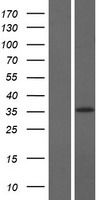 LRRC75A / C17orf76 Protein - Western validation with an anti-DDK antibody * L: Control HEK293 lysate R: Over-expression lysate