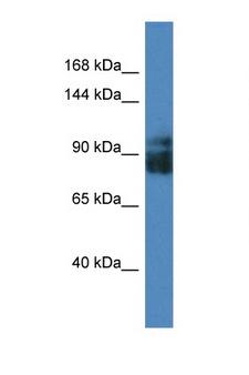 LRRC8A / LRRC8 Antibody - LRRC8A antibody Western blot of Fetal Heart lysate. Antibody concentration 1 ug/ml. This image was taken for the unconjugated form of this product. Other forms have not been tested.
