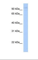 LRRC8A / LRRC8 Antibody - Jurkat cell lysate. Antibody concentration: 1.0 ug/ml. Gel concentration: 12%.  This image was taken for the unconjugated form of this product. Other forms have not been tested.