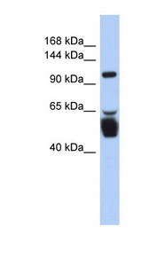 LRRC8B Antibody - LRRC8B antibody Western blot of Fetal Stomach lysate. This image was taken for the unconjugated form of this product. Other forms have not been tested.