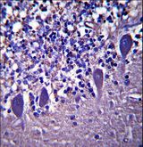 LRRC8B Antibody - LRRC8B Antibody (N-term ) immunohistochemistry of formalin-fixed and paraffin-embedded human cerebellum tissue followed by peroxidase-conjugated secondary antibody and DAB staining.