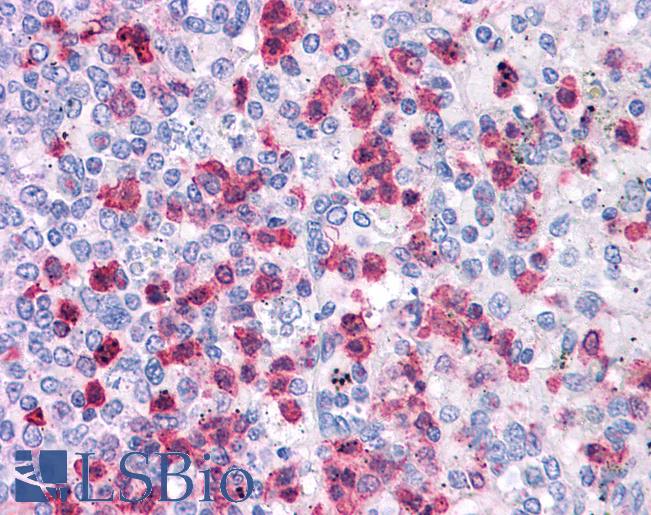 LRRC8B Antibody - Anti-LRRC8B antibody IHC of human spleen. Immunohistochemistry of formalin-fixed, paraffin-embedded tissue after heat-induced antigen retrieval. Antibody concentration 5 ug/ml.  This image was taken for the unconjugated form of this product. Other forms have not been tested.
