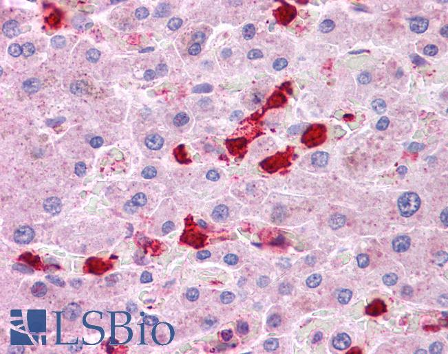 LRRC8B Antibody - Anti-LRRC8B antibody IHC of human liver. Immunohistochemistry of formalin-fixed, paraffin-embedded tissue after heat-induced antigen retrieval. Antibody concentration 5 ug/ml.  This image was taken for the unconjugated form of this product. Other forms have not been tested.