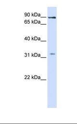 LRRC8B Antibody - Fetal liver lysate. Antibody concentration: 1.0 ug/ml. Gel concentration: 12%.  This image was taken for the unconjugated form of this product. Other forms have not been tested.