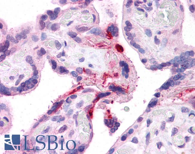LRRC8B Antibody - Anti-LRRC8B antibody IHC of human placenta. Immunohistochemistry of formalin-fixed, paraffin-embedded tissue after heat-induced antigen retrieval. Antibody concentration 5 ug/ml.  This image was taken for the unconjugated form of this product. Other forms have not been tested.