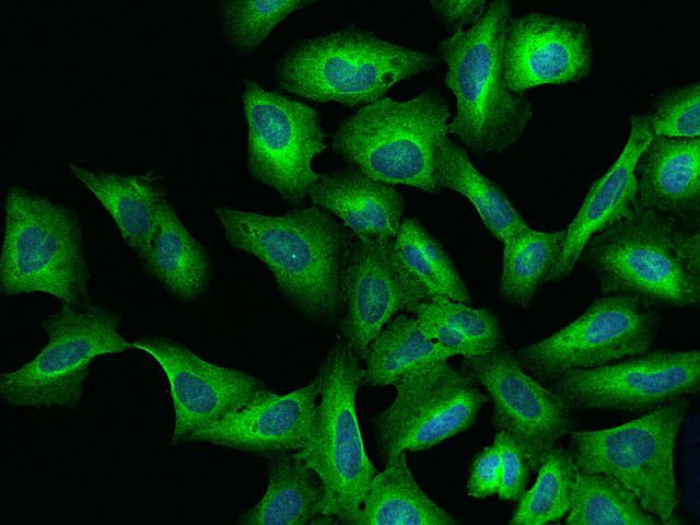 LRRC8B Antibody - Immunofluorescence staining of LRRC8B in U2OS cells. Cells were fixed with 4% PFA, permeabilzed with 0.1% Triton X-100 in PBS, blocked with 10% serum, and incubated with rabbit anti-Human LRRC8B polyclonal antibody (dilution ratio 1:200) at 4°C overnight. Then cells were stained with the Alexa Fluor 488-conjugated Goat Anti-rabbit IgG secondary antibody (green) and counterstained with DAPI (blue). Positive staining was localized to Cytoplasm.