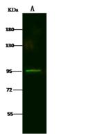 LRRC8B Antibody - Anti-LRRC8B rabbit polyclonal antibody at 1:500 dilution. Lane A: NCI-H292 Whole Cell Lysate. Lysates/proteins at 30 ug per lane. Secondary: Goat Anti-Rabbit IgG (H&L) /Dylight 800 at 1/10000 dilution. Developed using the Odyssey technique. Performed under reducing conditions. Predicted band size: 92 kDa. Observed band size: 92 kDa.