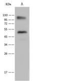 LRRC8D / LRRC5 Antibody - Anti-LRRC8D rabbit polyclonal antibody at 1:500 dilution. Lane A: HeLa Whole Cell Lysate. Lysates/proteins at 30 ug per lane. Secondary: Goat Anti-Rabbit IgG (H+L)/HRP at 1/10000 dilution. Developed using the ECL technique. Performed under reducing conditions. Predicted band size: 98 kDa.