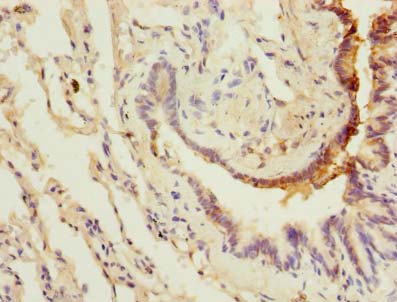 LRRC8E Antibody - Immunohistochemistry of paraffin-embedded human lung tissue using antibody at dilution of 1:100.