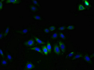LRRC8E Antibody - Immunofluorescent analysis of HepG2 cells using LRRC8E Antibody at dilution of 1:100 and Alexa Fluor 488-congugated AffiniPure Goat Anti-Rabbit IgG(H+L)