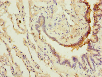 LRRC8E Antibody - Immunohistochemistry of paraffin-embedded human lung tissue using LRRC8E Antibody at dilution of 1:100