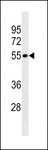 LRRIQ4 Antibody - LRRIQ4 Antibody western blot of Uterus tissue lysates (35 ug/lane). The LRRIQ4 antibody detected the LRRIQ4 protein (arrow).