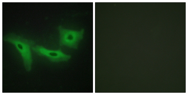 LRRK1 Antibody - Immunofluorescence analysis of HeLa cells, using LRRK1 Antibody. The picture on the right is blocked with the synthesized peptide.