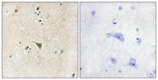 LRRK1 Antibody - Immunohistochemistry analysis of paraffin-embedded human brain tissue, using LRRK1 Antibody. The picture on the right is blocked with the synthesized peptide.
