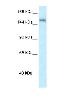 LRRK1 Antibody - LRRK1 antibody Western blot of HepG2 Cell lysate. Antibody concentration 1 ug/ml.  This image was taken for the unconjugated form of this product. Other forms have not been tested.