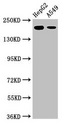 LRRK1 Antibody - Western Blot Positive WB detected in:HepG2 whole cell lysate,A549 whole cell lysate All Lanes:LRRK1 antibody at 3µg/ml Secondary Goat polyclonal to rabbit IgG at 1/50000 dilution Predicted band size: 226,29 KDa Observed band size: 226 KDa