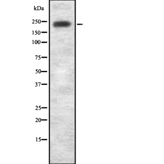 LRRK1 Antibody - Western blot analysis of LRRK1 using Jurkat whole cells lysates