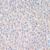LRRK2 Antibody - Immunohistochemistry of paraffin-embedded Rat liver using LRRK2 Polyclonal Antibody at dilution of 1:200 (40x lens).