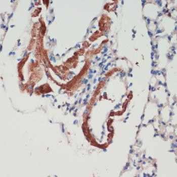 LRRK2 Antibody - Immunohistochemistry of paraffin-embedded Mouse lung using LRRK2 Polyclonal Antibody at dilution of 1:200 (40x lens).